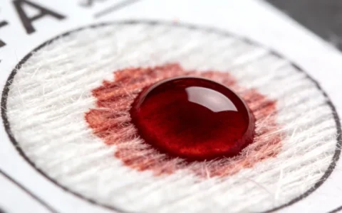 白山关节液mNGS基因检测检测哪家靠谱？最新正规机构名单与避坑要点