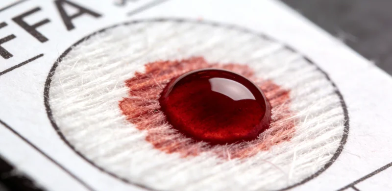 白山市民在医院咨询关节疼痛问题