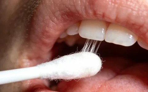 日照CSF mNGS基因检测十大排名