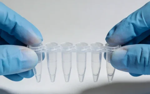 玉树膀胱癌基因检测在哪里验