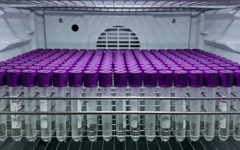 新余隐球菌基因检测需要到哪里办理