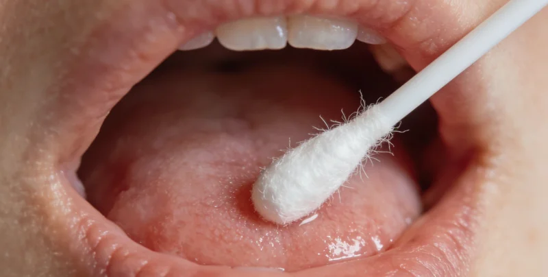 高倍显微镜下观察到的被巨细胞病