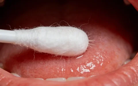 马鞍山胸腔积液mNGS基因检测科室在哪里