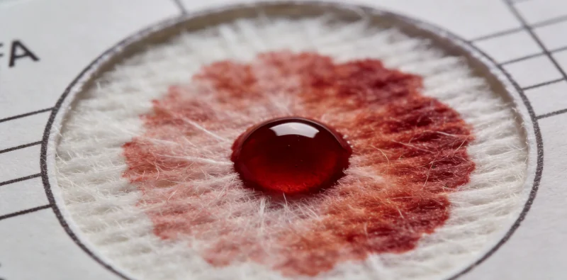 专业人员演示正确采集鼻咽拭子样