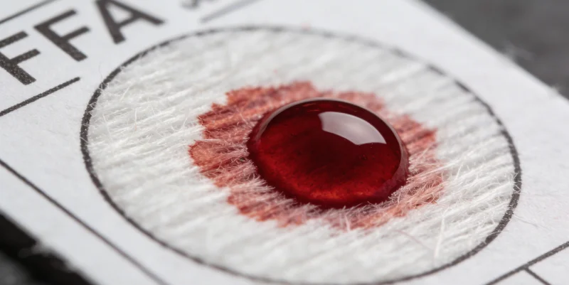 医生正在为患者进行支气管镜检查