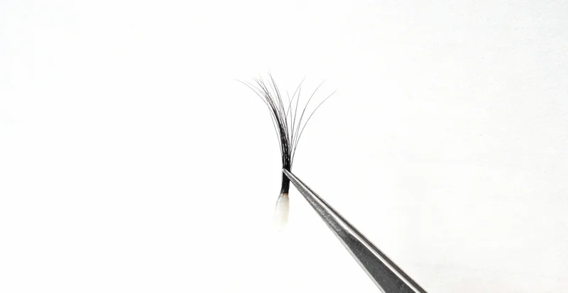 榆林市民在医院进行甲状腺超声检查的场景