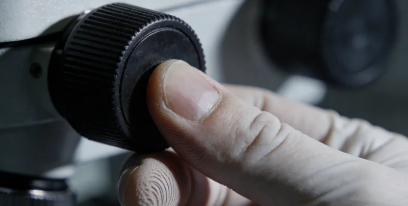 肺部CT影像与基因检测报告对比