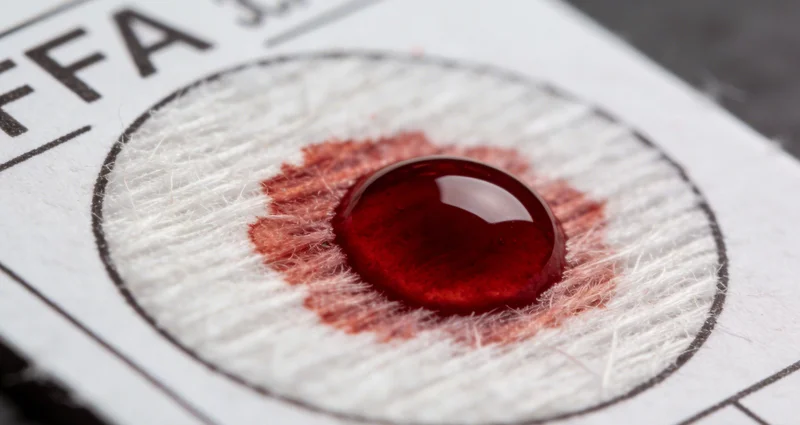 寄生虫检测样本正确采集方法