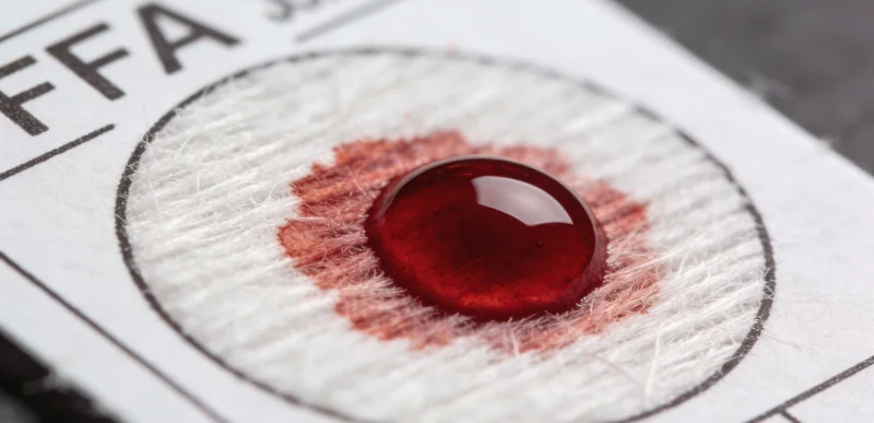 医护人员正在为检测者采集静脉血