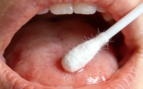 秦皇岛食管癌基因检测哪家公司好