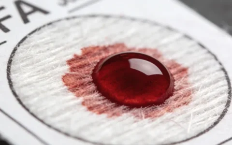 合肥关节液mNGS基因检测哪家最准