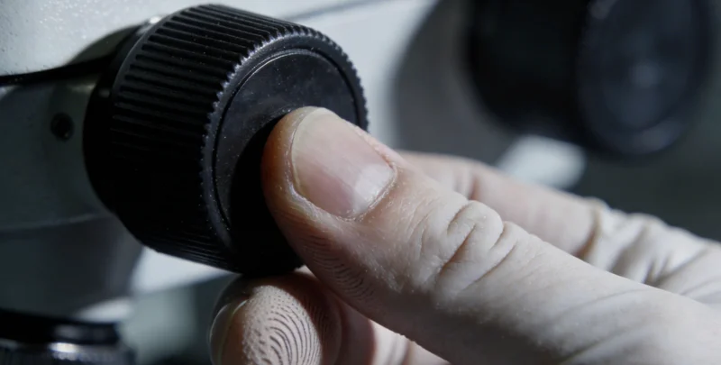 医生正在电脑前仔细分析CSF 