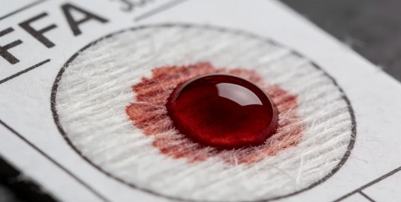 医护人员正在为患者采集用于混合