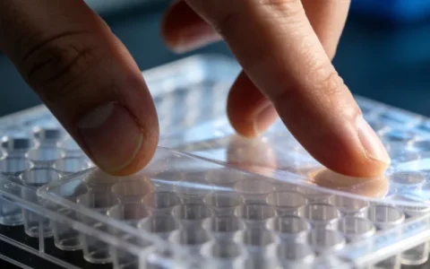 阳泉RNA mNGS基因检测一般哪里做