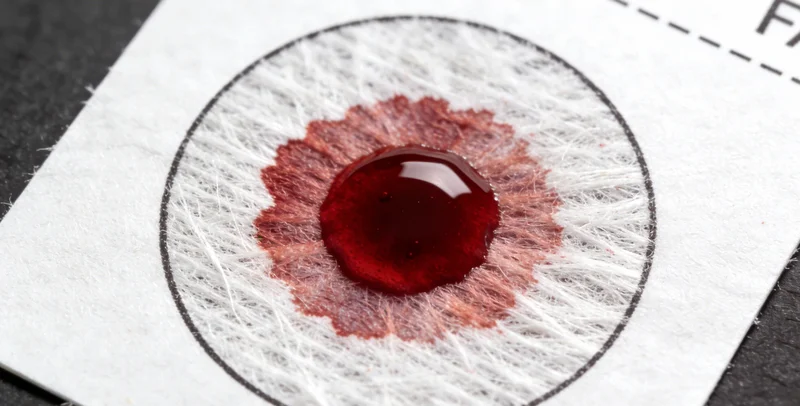 专业医护人员进行宫颈采样操作演