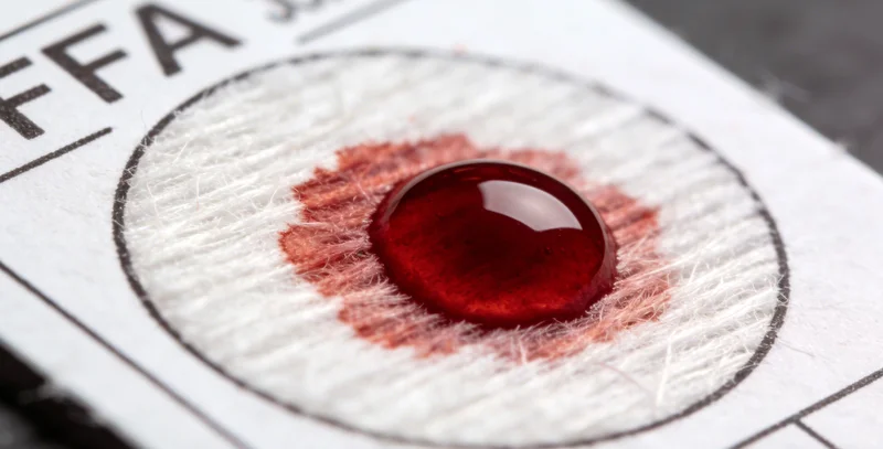 医护人员展示如何正确使用粪便采