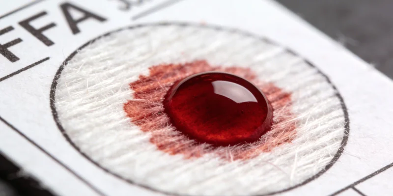 医护人员向患者展示如何正确留取