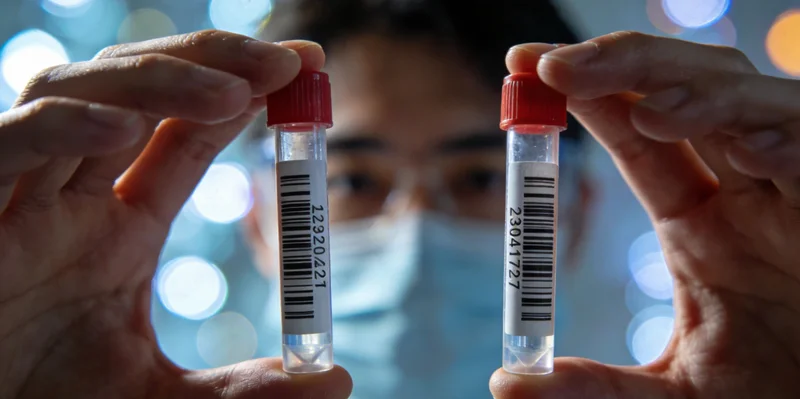 医生进行支气管肺泡灌洗(BAL