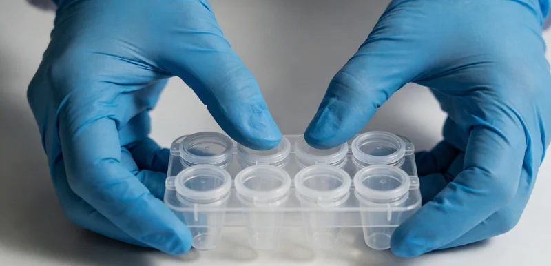 专业人员在实验室进行样本处理