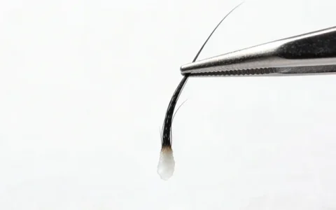 上饶CMV基因检测公司怎么选？一文说清正规公司与避坑要点