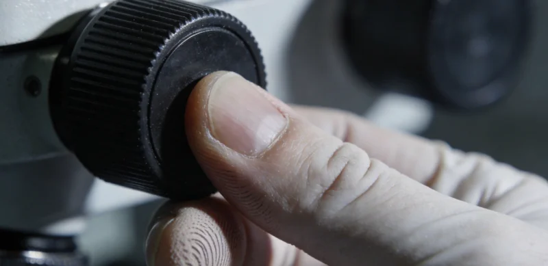 病因诊断与针对性治疗流程图表