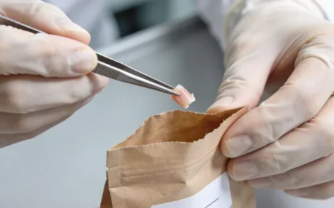 随州CSF mNGS基因检测机构地址在哪里