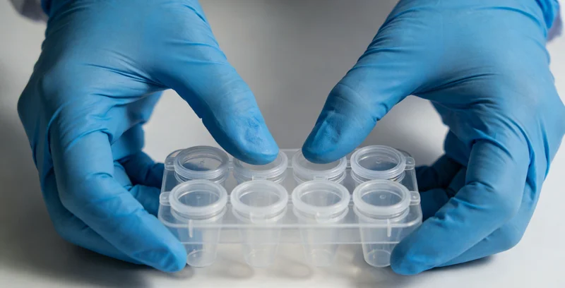 实验室技术人员正在进行样本前处