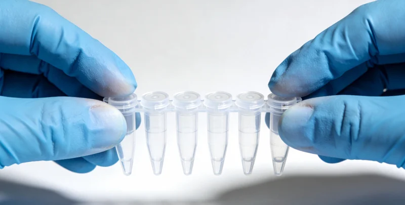 铜仁市民在医疗机构咨询膀胱癌基因检测服务