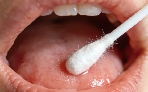 儋州曲霉菌基因检测公司怎么选？全新挑选指南与避坑建议