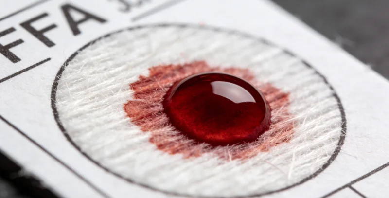 正确的痰液样本采集方法演示