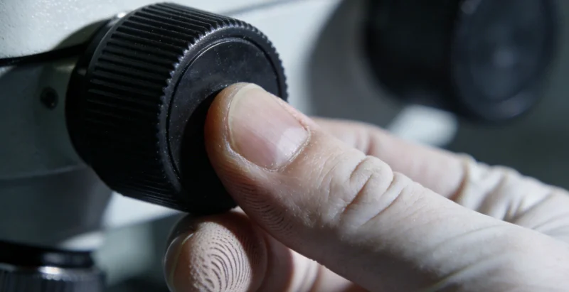 医生在电脑前认真分析mNGS检