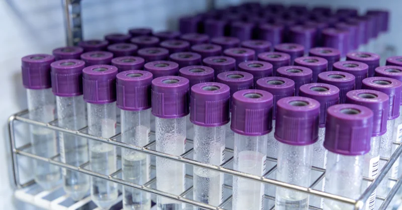 医生正在查看脑部磁共振影像，讨论病情