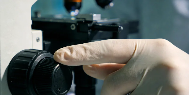 医生团队在讨论肺部感染的CT影