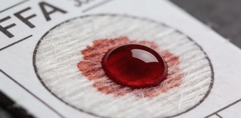 医护人员正在规范采集血液样本，