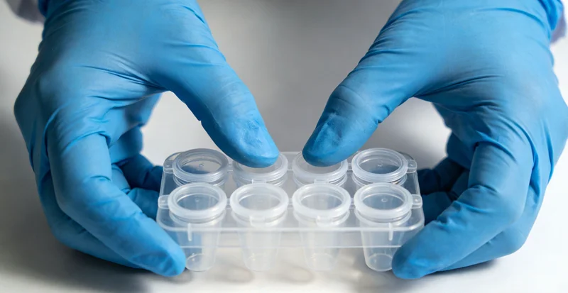 专业基因检测报告解读场景