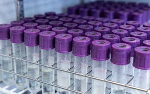 荆门前列腺癌基因检测指南3家可靠机构与2026年信息归纳