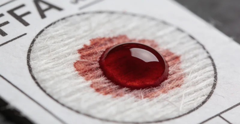 痰液样本采集与送检过程示意图