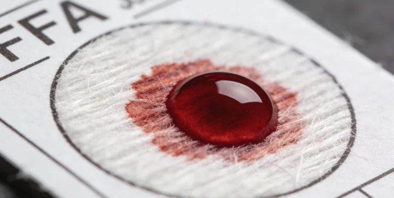 呼吸道病原体检测的标准化采样操