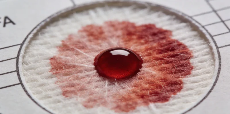 医护人员正在规范采集脑脊液样本