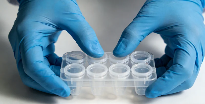 专业的髓母细胞瘤基因检测报告展示