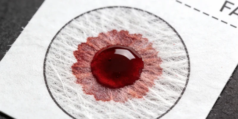 实验室技术人员正在处理血液检测