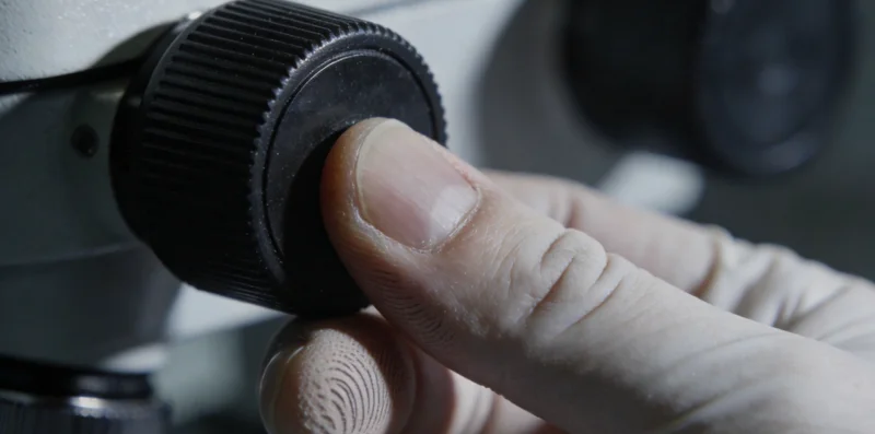 一位医生正在分析检验报告单,背