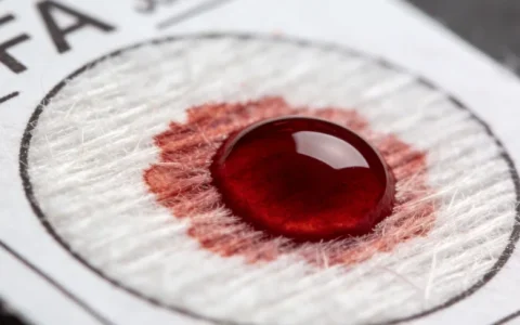 平顶山脑肿瘤基因检测检测中心