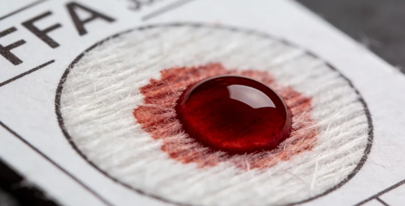 专业的样本采集和运输流程