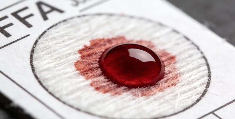 医护人员规范采集血液样本并放入