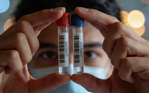 宜宾前列腺癌基因检测专业机构地址