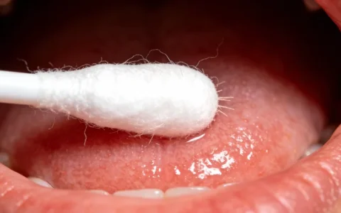 运城脑膜瘤基因检测最新消息地址