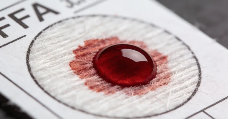 医疗人员通过支气管镜进行肺泡灌