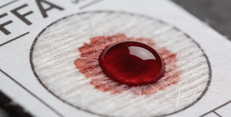 脓毒症基因检测采样和实验室流程