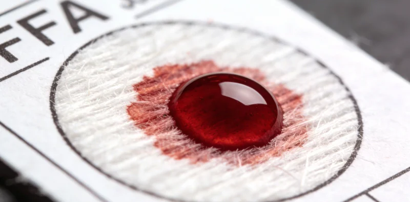 医护人员正在轻柔地进行宫颈拭子